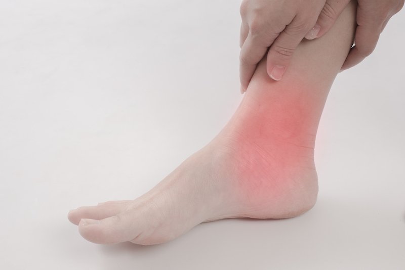 Cankles: What Are They & How To Avoid Them